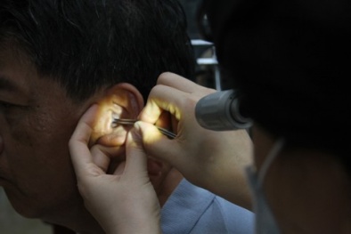 Điếc vì lấy ráy tai