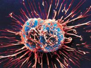 Phát hiện sớm tế bào ung thư trong máu bằng âm thanh