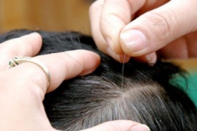  Bắt bệnh qua vị trí... tóc bạc