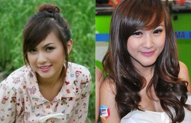 Tiết lộ gây sốc của 'hotgirl' đi phẫu thuật thẩm mỹ