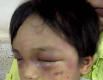 Cháu bé 3 tuổi bị đánh, bắt đi ăn xin: mẹ đồng lõa?