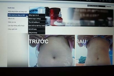 Đua nhau đi...hút mỡ, thẩm mỹ