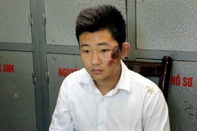 Bảo vệ thẩm mỹ viện làm gì sau khi cùng giám đốc ném xác phi tang?