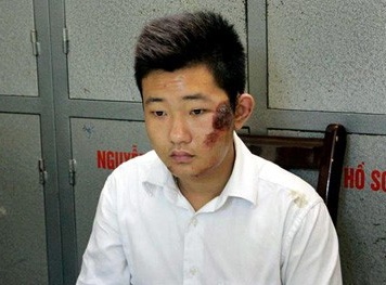 Dựng lại hiện trường bác sỹ, bảo vệ ném xác phi tang nạn nhân thẩm mỹ viện