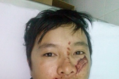 Thầy giáo bị đánh nhập viện