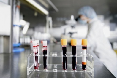 Xét nghiệm máu có thể dự đoán cái chết