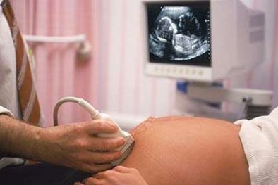  Đừng ghi hình thai nhi để làm kỷ niệm!