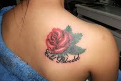 Mất xinh, hóa sẹo vì xóa hình xăm