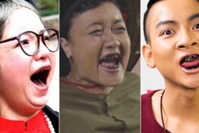 Hốt hoảng những hàm răng đen xì của sao Việt