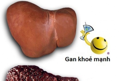 Nước giải rượu Picoman: Quảng cáo gây hiểu lầm!