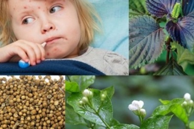 Cách hữu dụng phòng bệnh sởi khi chưa kịp tiêm phòng