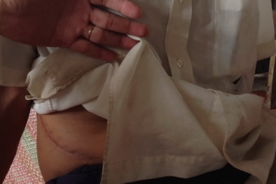 Nông dân nghèo bán thận ở Cần Thơ: Công an điều tra được gì?