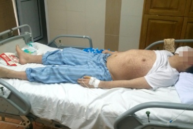 Gần 50 tuổi nhưng vẫn mắc sởi