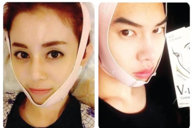 'Méo mặt' vì ... thẩm mỹ V-line