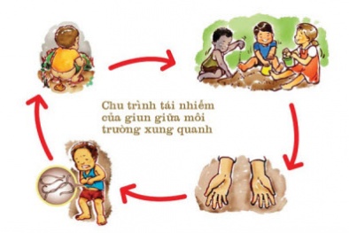 Tạm dừng tẩy giun cho trẻ