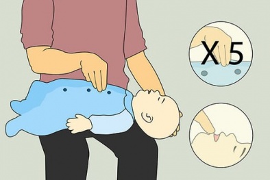 Trẻ bị hóc thạch nên làm gì?