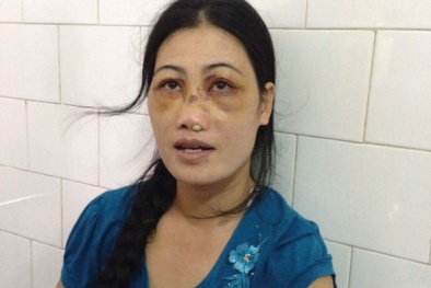 Phẫn nộ vụ chồng bắt vợ ăn phân lợn, dùng kim đâm vào vùng kín