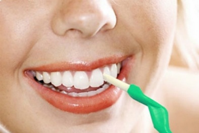 Tiền mất tật mang vì thuốc tẩy trắng răng