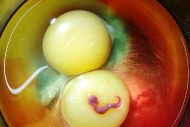 Kinh hoàng phát hiện trứng chứa… ấu trùng lạ