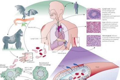 Cách nhận biết và điều trị dịch Ebola