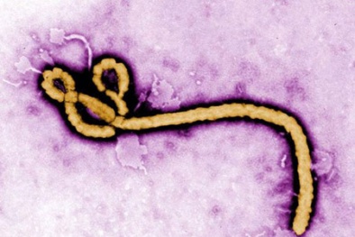 Ebola có lây qua đường tình dục?