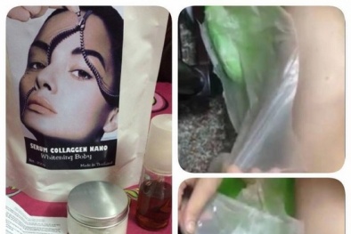 Tổn thương da vì dùng kem thay da collagen