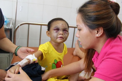 Bố mẹ 'dạy' con 4 tuổi đến chấn thương sọ não: Thông tin thêm từ Công an