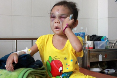 Thông tin mới nhất vụ cháu bé 4 tuổi bị bạo hành dã man ở Bình Dương