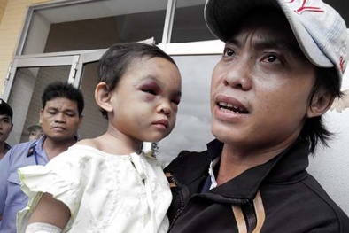 Tin mới nhất vụ cháu bé 4 tuổi bị bạo hành ở Bình Dương gây phẫn nộ