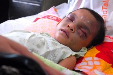 Vụ bé gái bị đánh đập ở Bình Dương: Có thể khởi tố về tội “giết người”