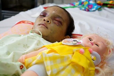 Ai được nuôi bé gái 4 tuổi bị bạo hành dã man ở Bình Dương?