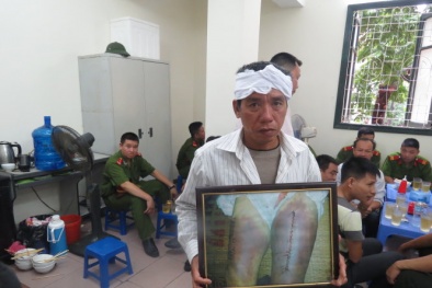 Kinh hoàng nhóm công an say rượu đánh chết người