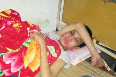 Cháu bé 14 tuổi khuyết tật bị đánh dã man