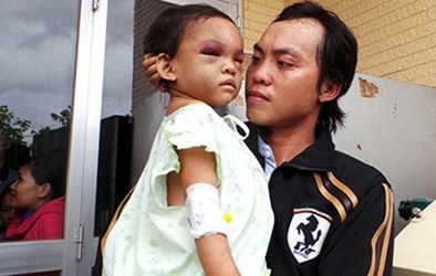 Vụ cháu bé 4 tuổi bị bạo hành dã man: Xét nghiệm ADN 