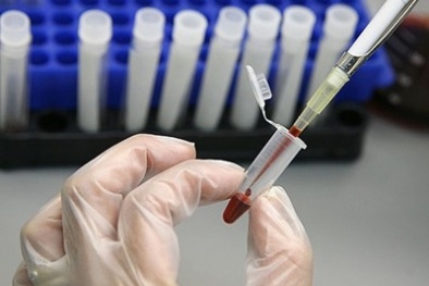 Thiết bị phát hiện ung thư chỉ sau một giờ thử máu 