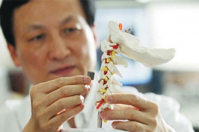 Vật liệu gốm y sinh ứng dụng trong cấy ghép cơ thể người