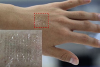 Bước đột phá mới trong công nghệ da điện tử