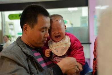 Kinh hoàng bé 11 tháng bị ghim 12 mũi kim vào người