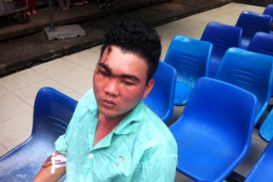 Tạm đình chỉ 1 cảnh sát cơ động 'vung gậy' làm hỏng mắt người dân