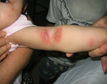 Kiến ba khoang ồ ạt 'tái xuất' ở Hà Nội