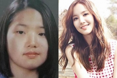 Cách phẫu thuật thẩm mỹ an toàn mới