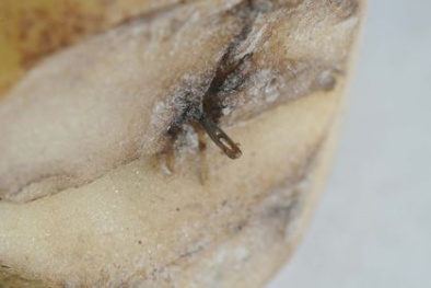 Phát hiện kim khâu trong khoai tây 