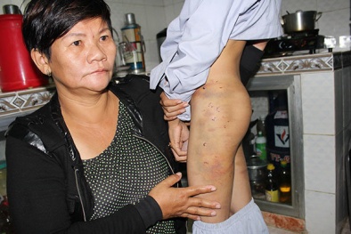 Khởi tố vụ hai chú tiểu bị đánh đập dã man