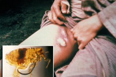 Cảnh báo về nỗi kinh hoàng từ 'cái chết đen'