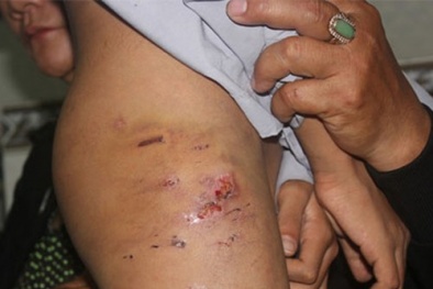 Kinh hoàng 2 chú tiểu bị đánh đập tàn tệ