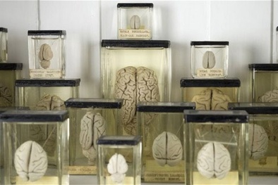 100 bộ não mẫu vật của đại học Texas biến mất không rõ lý do