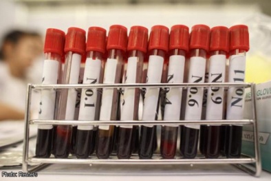 Truyền máu nhiễm vi rút viêm gan, HIV cho bệnh nhân Pakistan