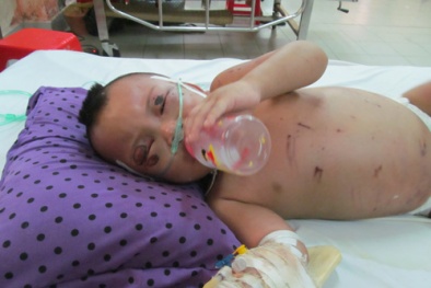 Bà ngoại bị nghi đánh dã man bé trai 2 tuổi