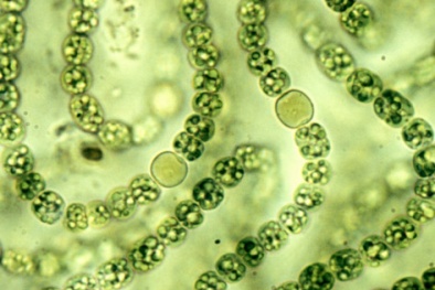 Vi khuẩn cổ gây hiểm họa toàn cầu tái xuất và phát triển