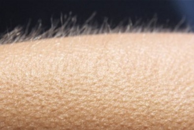 Những phản ứng kỳ lạ của cơ thể với cái lạnh